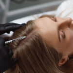 The Many Benefits Of Mesotherapy For Hair